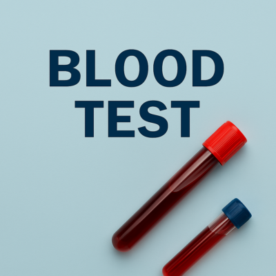 How to prepare for the lab tests